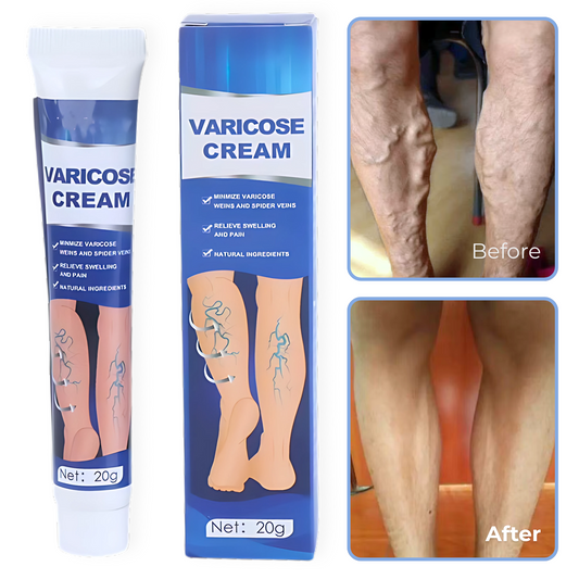 Varicose Relief Cream